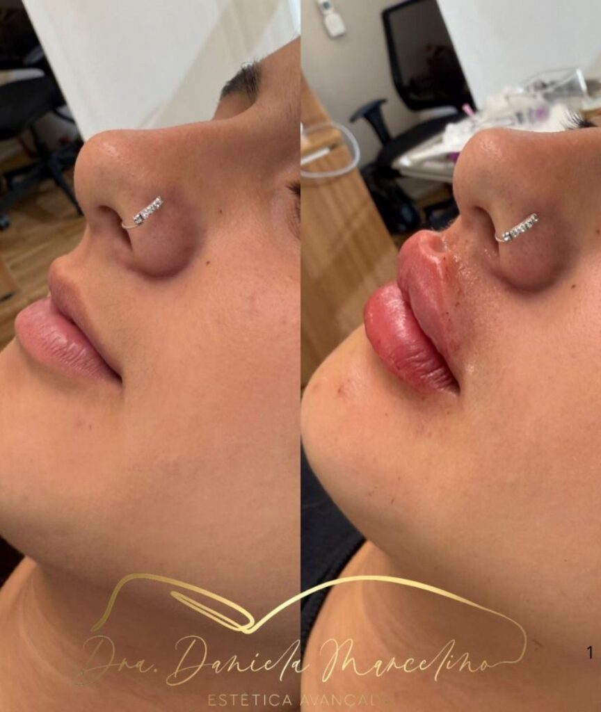 especialista em labios (1)