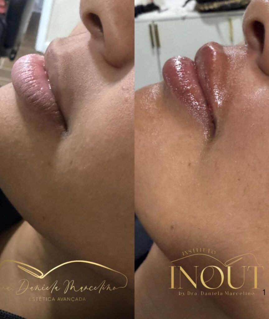 especialista em labios (10)