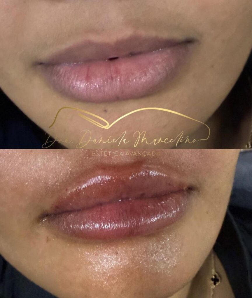 especialista em labios (12)