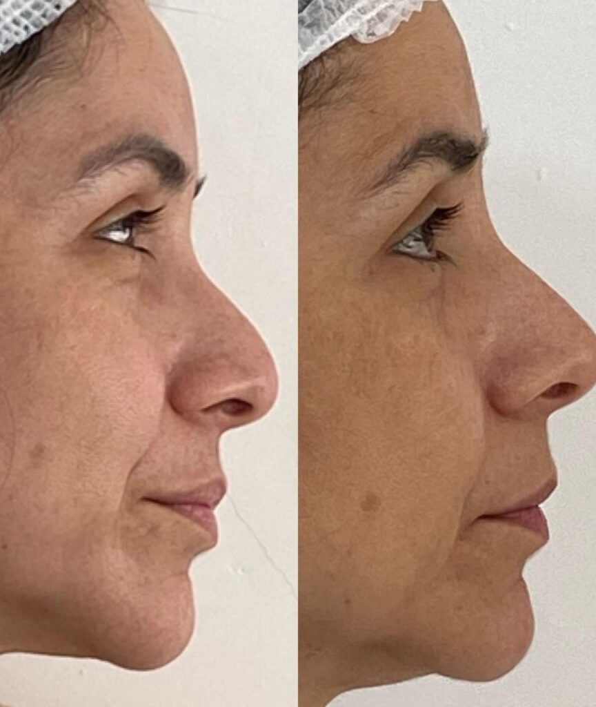 especialista em labios (13)