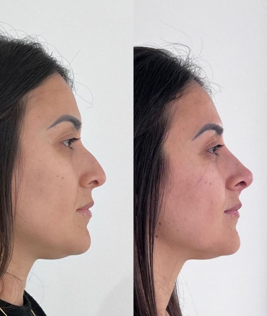 especialista em labios (14)