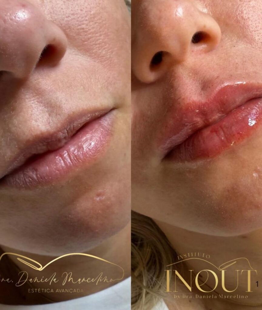 especialista em labios (15)