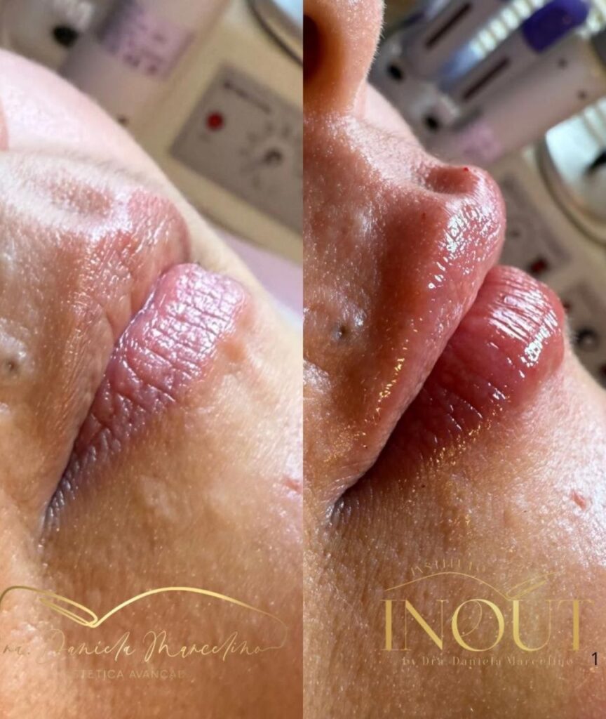 especialista em labios (16)