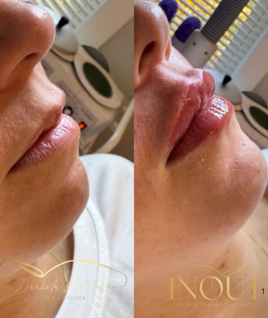 especialista em labios (17)