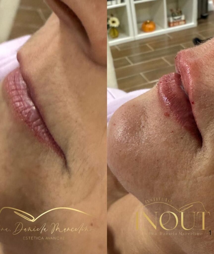 especialista em labios (18)