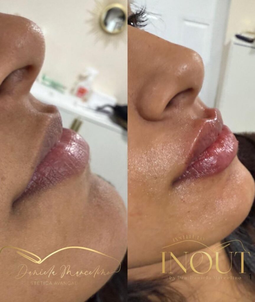 especialista em labios (19)