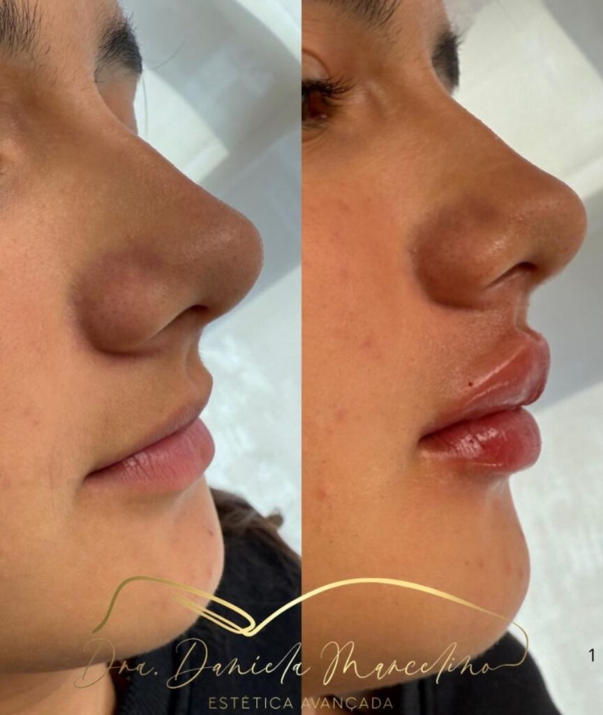 especialista em labios (2)