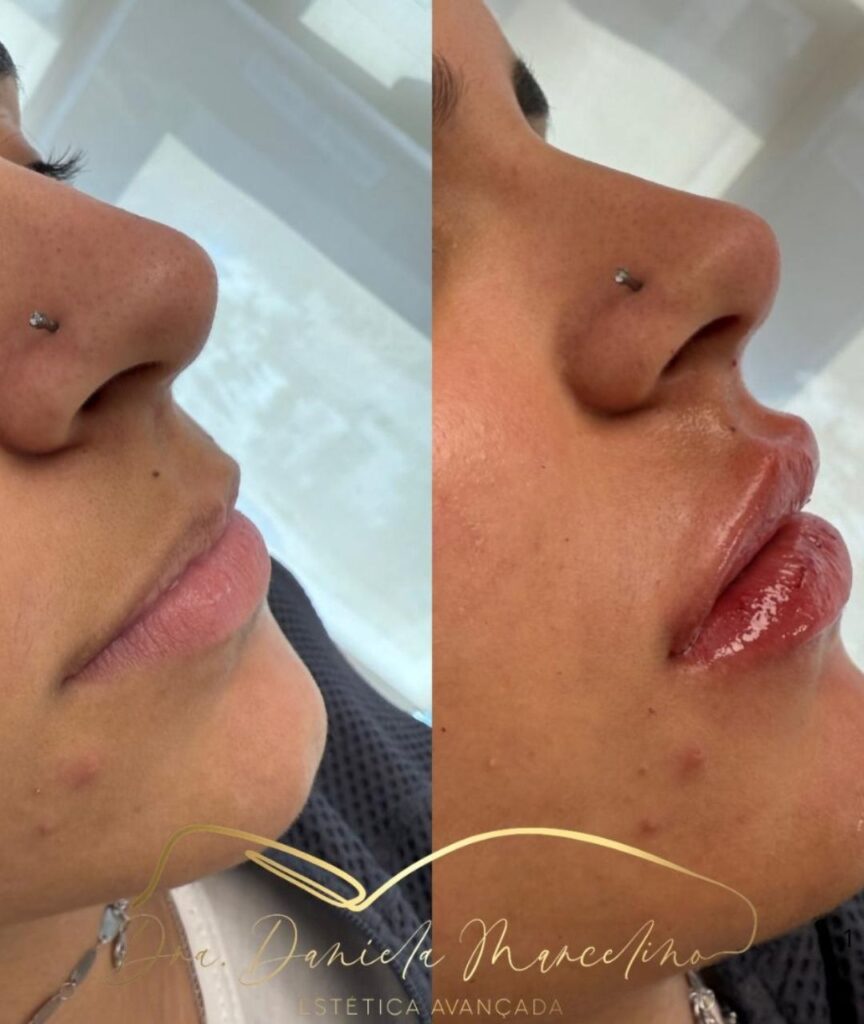 especialista em labios (20)