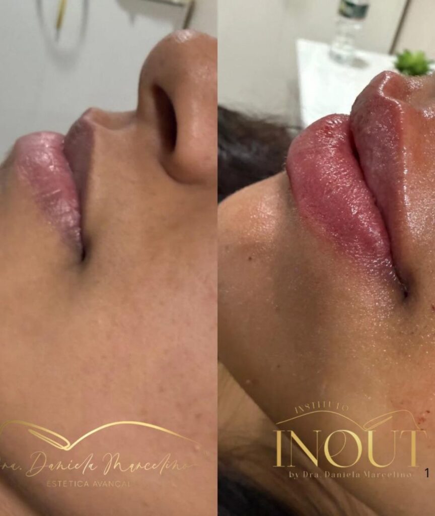 especialista em labios (22)