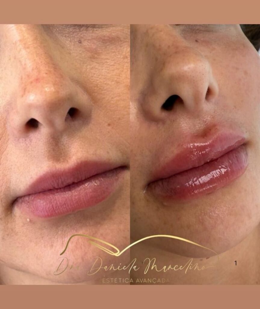 especialista em labios (3)