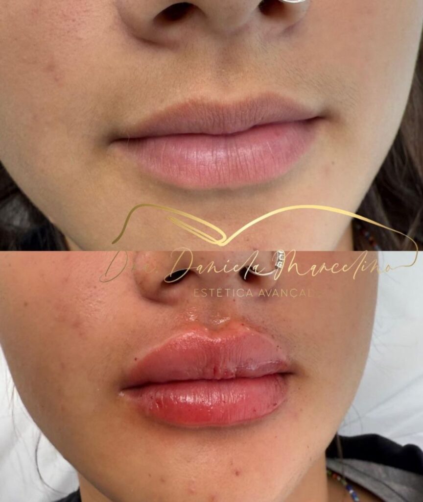 especialista em labios (4)
