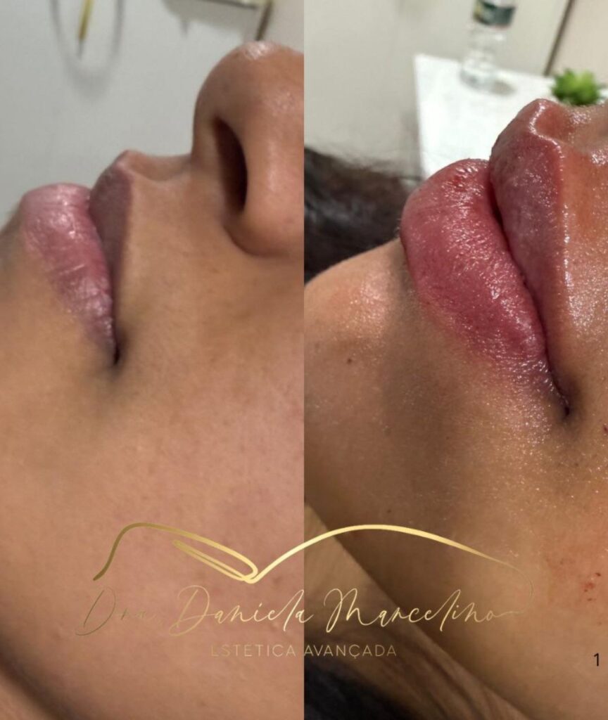 especialista em labios (5)