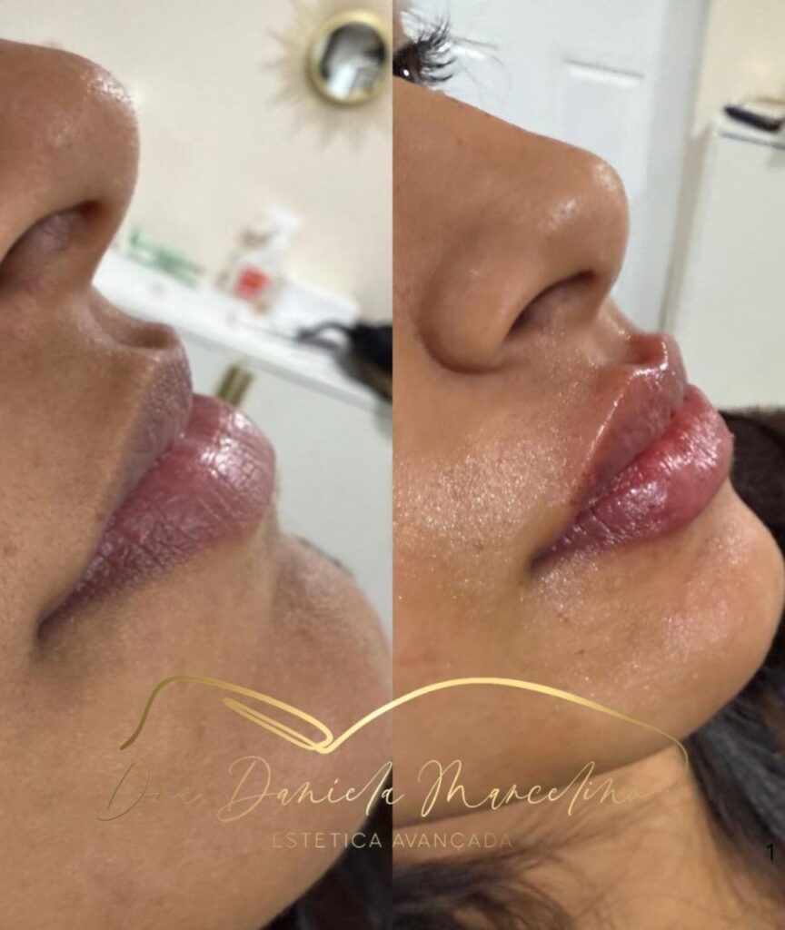 especialista em labios (6)