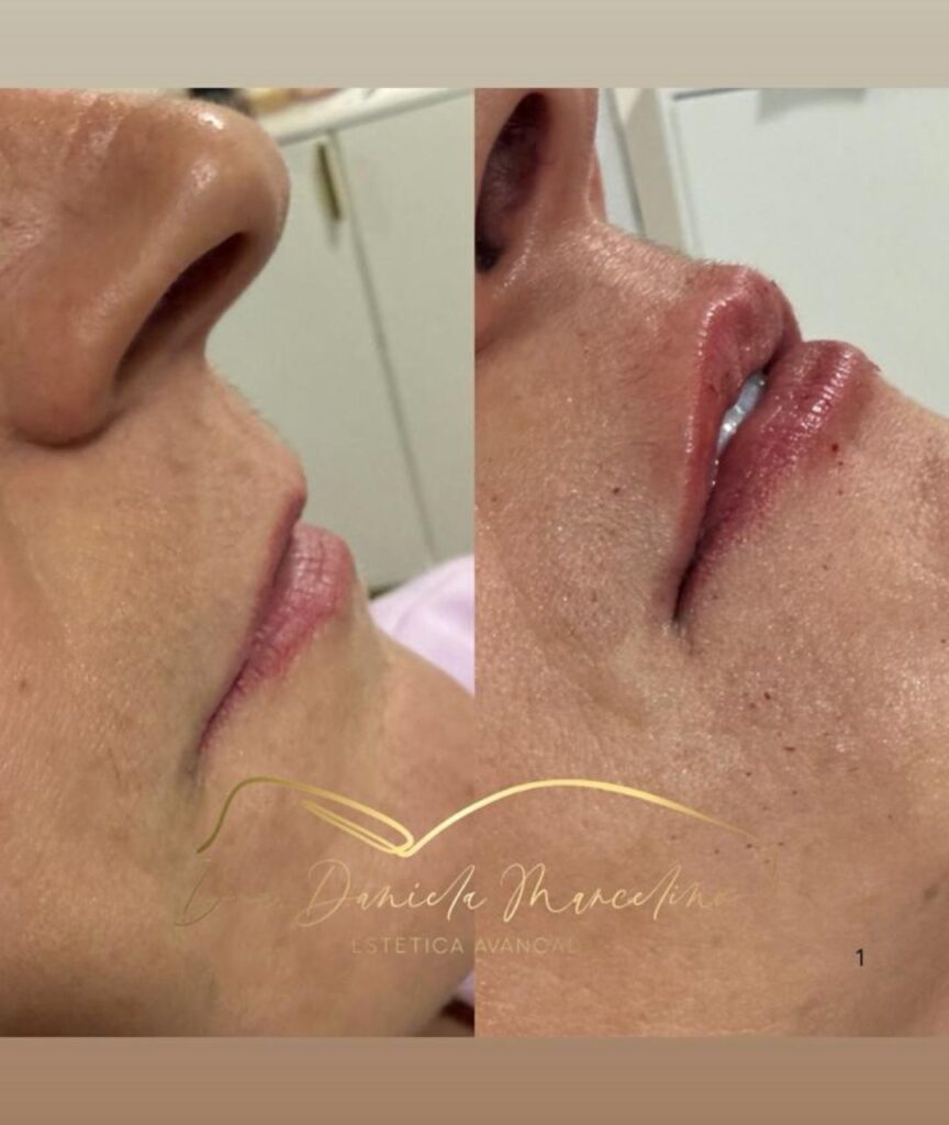 especialista em labios (8)
