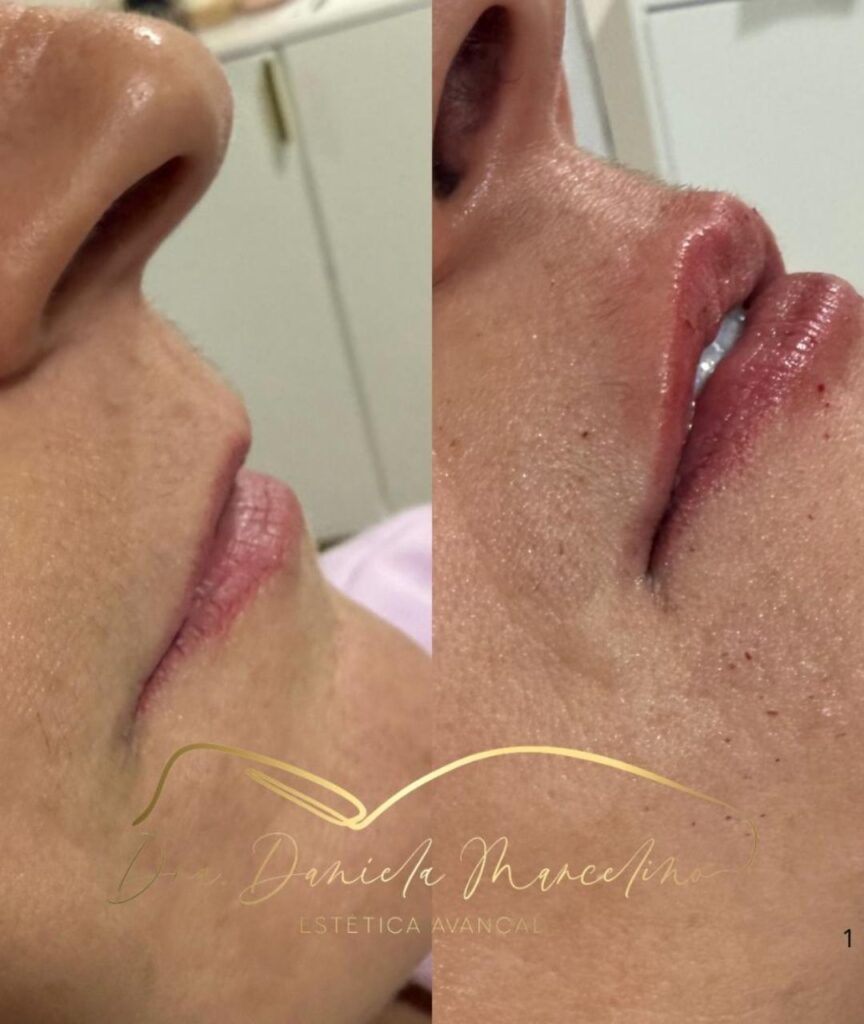 especialista em labios (9)