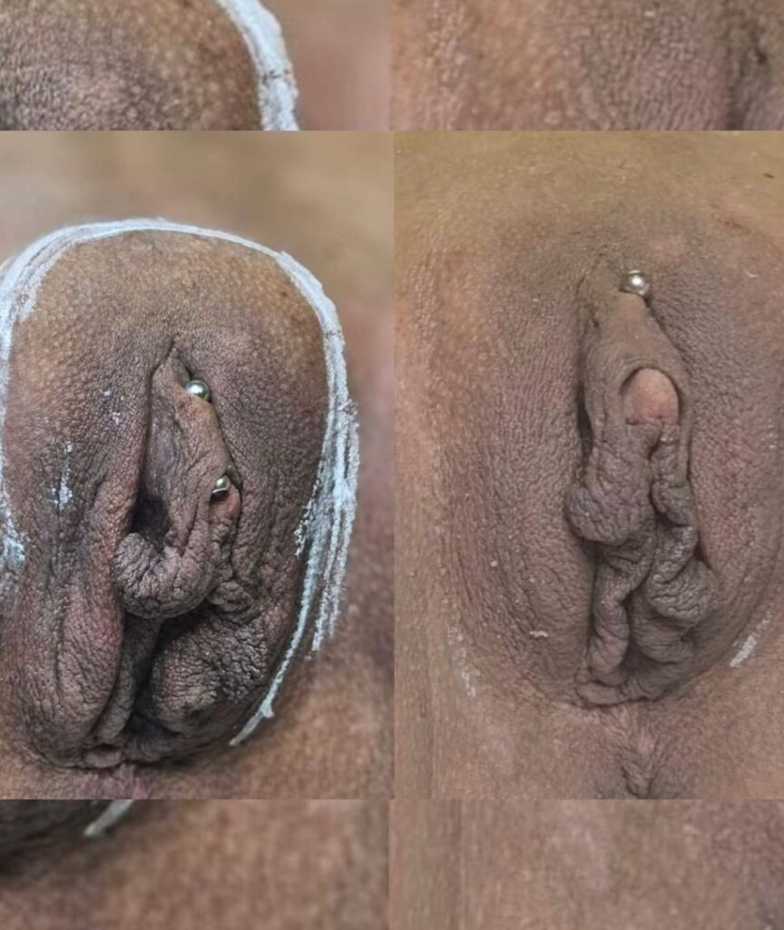 harmonizacao intima (4)