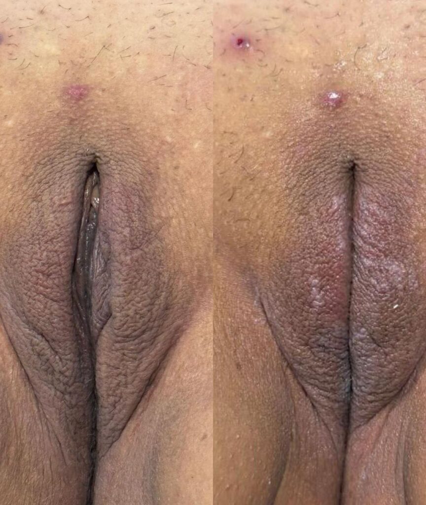 harmonizacao intima (5)